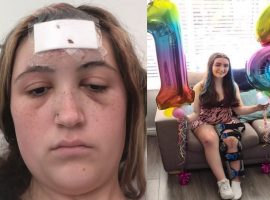 “Not only did they save my life but they gave me a second chance”- Young girl who attempted suicide launches fundraiser for Salford Royal staff