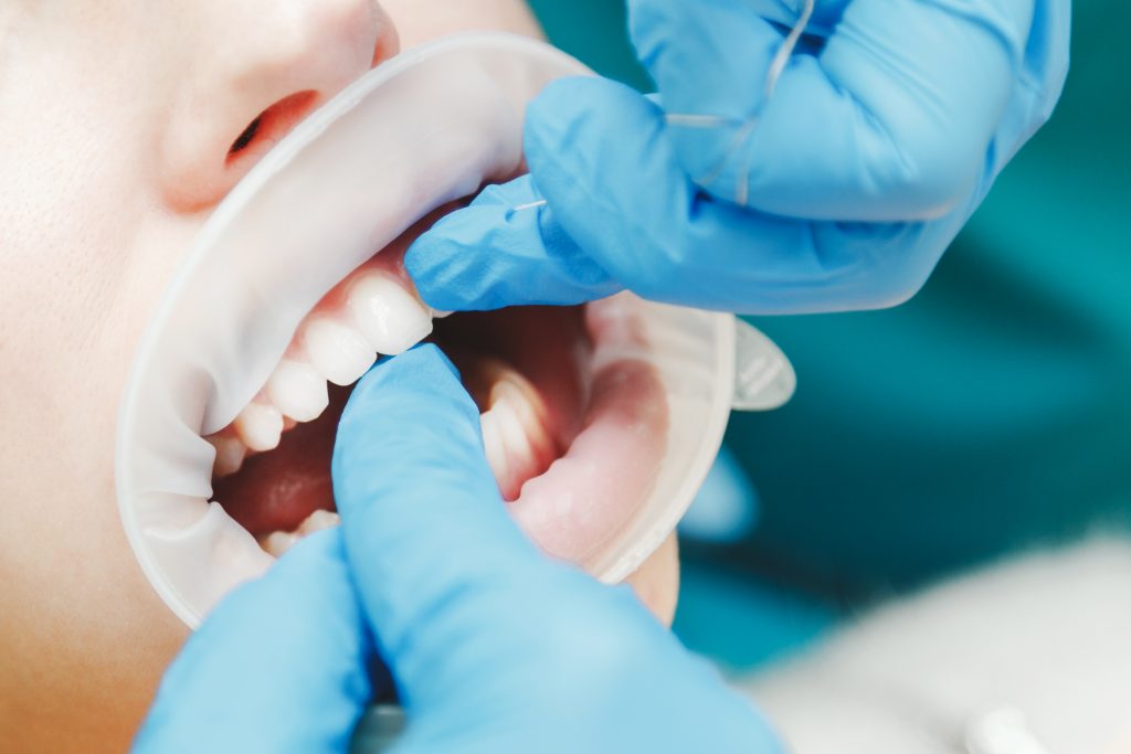 Salford statistics for dental health are here and they are shocking 2018