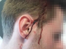 Police Officer attacked by youths in Salford