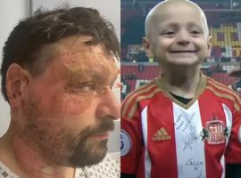 Football mascot’s dad left unable to work after serious work accident